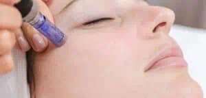 Pigmentation Removal